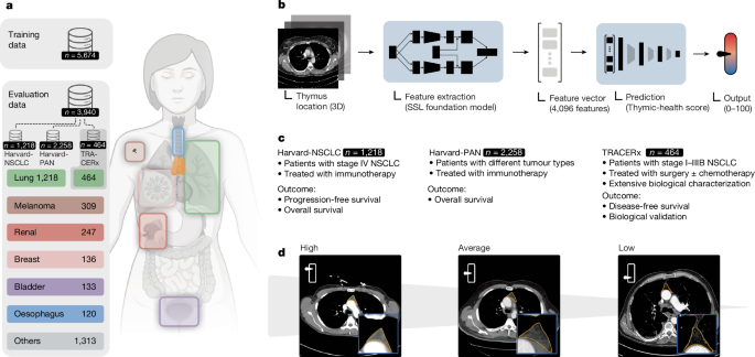 Thymic health and immunotherapy outcomes in patients with cancer - Nature