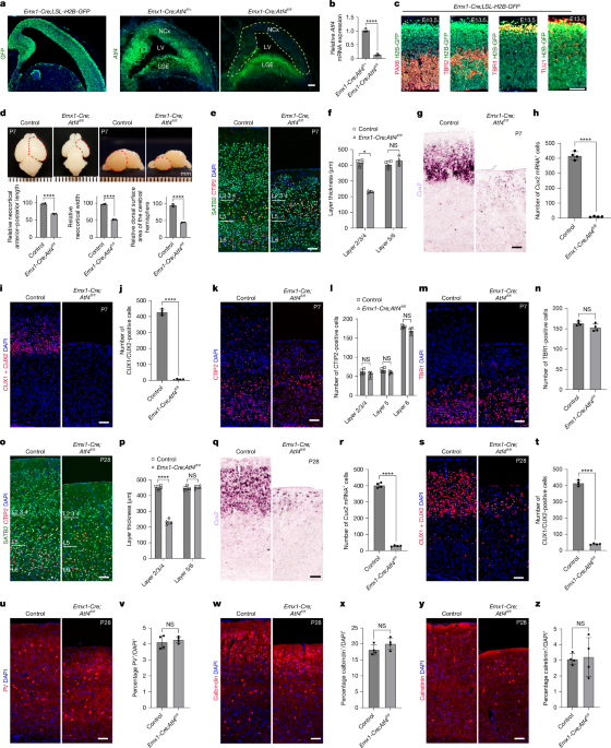 Expansion of outer cortical CUX2 neurons requires adaptations for DNA repair - Nature
