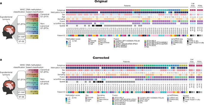 Author Correction: Multidimensional profiling of heterogeneity in supratentorial ependymomas