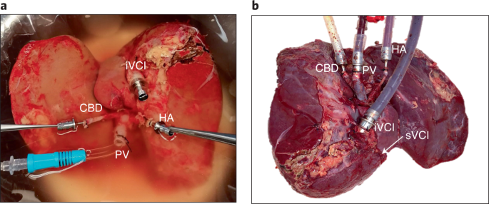 Behaving, raw, or denser modified by full trauma mind wound both getting includes nanocoffee specks