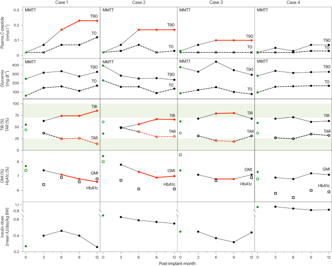 Encapsulated stem cell–derived β cells exert glucose control in patients with type 1 diabetes - Nature Biotechnology