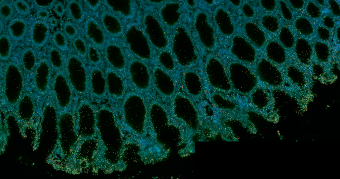 細胞アトラーゼを超えて：空間生物学は疾患の背後にあるメカニズムを明らかにしています
