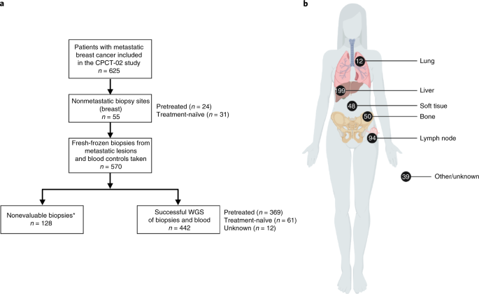 Breast Cancer Treatment Flow Chart