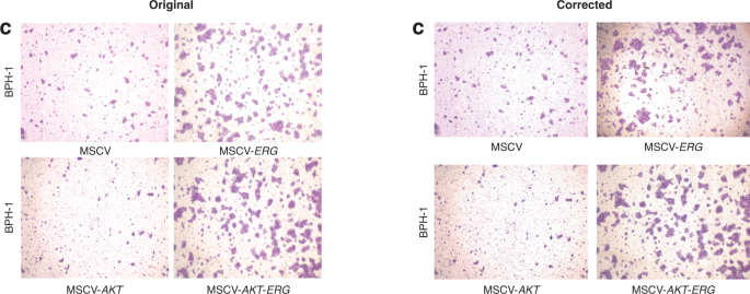 Author correction: aberrant erg expression cooperates with loss of pten to promote cancer progression in the prostate