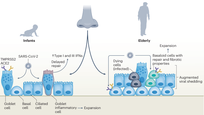 Aged nasal epithelium is more prone to severe COVID-19