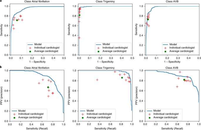 ecg classification deep learning