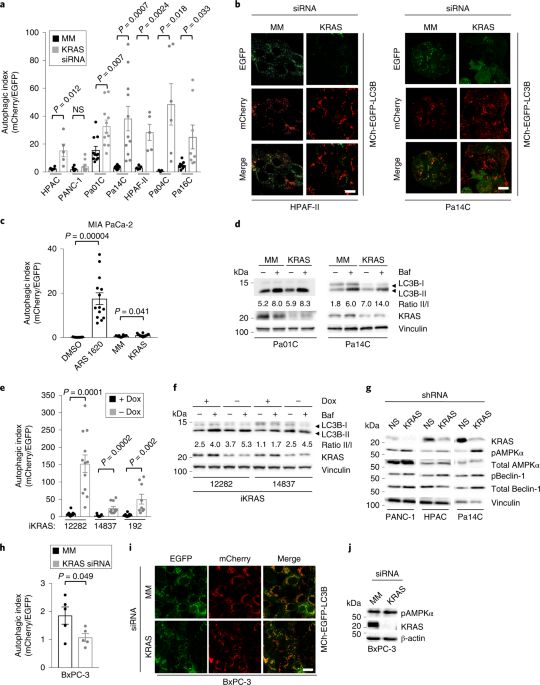 Combination Of Erk And Autophagy Inhibition As A Treatment Approach For Pancreatic Cancer Nature Medicine