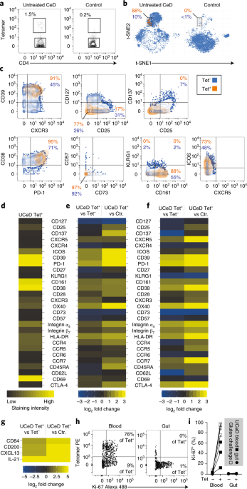 Distinct phenotype of CD4+ T cells driving celiac disease identified in multiple autoimmune conditions