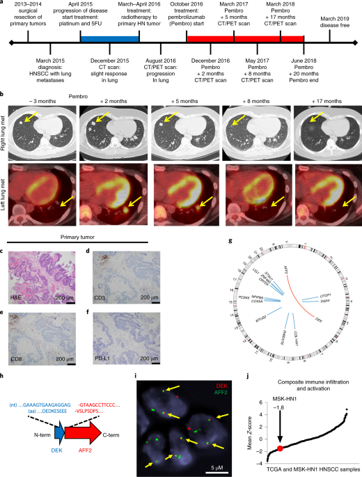 Immunogenic Neoantigens Derived From Gene Fusions Stimulate T Cell Responses Nature Medicine