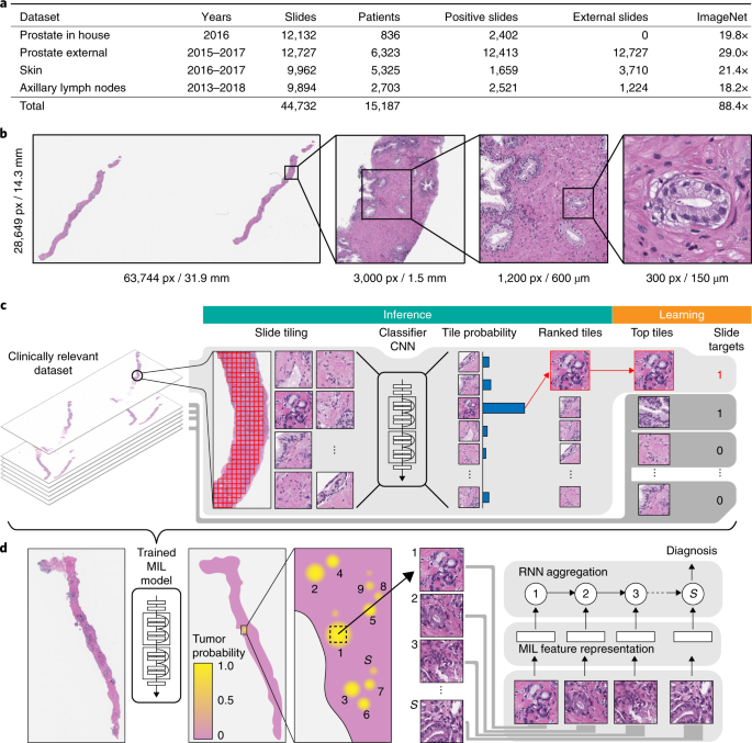 Clinical-grade computational pathology using weakly supervised 
