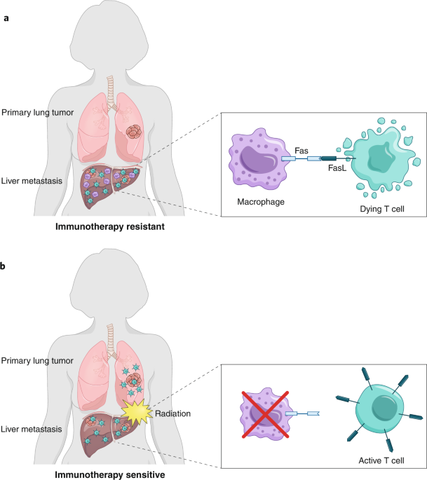 metastatic cancer immunotherapy