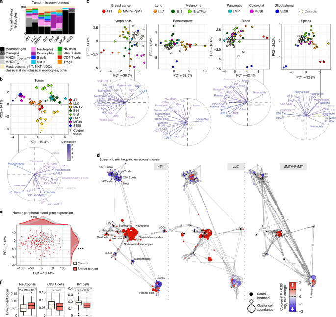 Systemic dysfunction and plasticity of the immune macroenvironment in cancer models