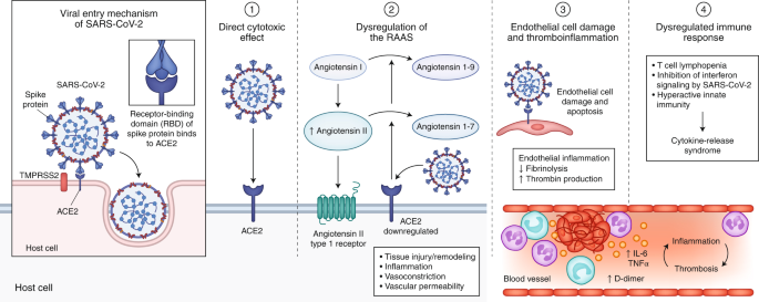 Extrapulmonary Manifestations Of Covid 19 Nature Medicine