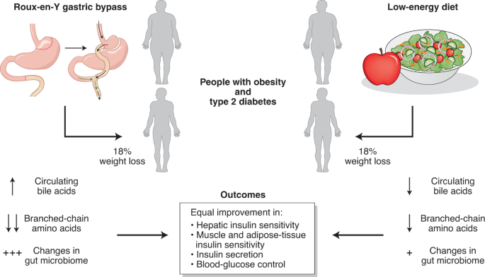 Weight loss is the major player in bariatric surgery benefits | Nature  Medicine
