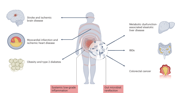 Western diets and chronic diseases | Nature Medicine
