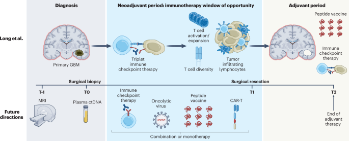 A new paradigm for immunotherapy in glioblastoma | Nature Medicine