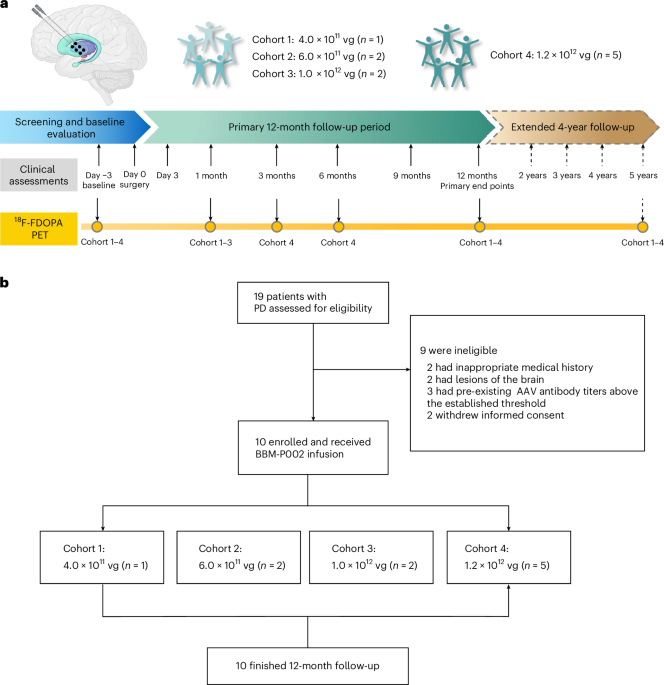 BBM-P002 Gene Therapy Shows Promise in Parkinson’s Disease Phase 1 Trial