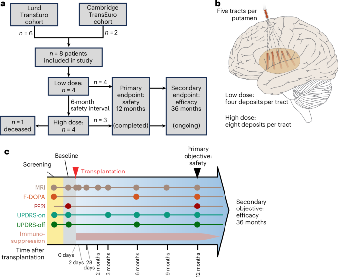 Human embryonic stem cell-derived dopaminergic cells for Parkinson’s disease: a phase 1/2 open-label trial