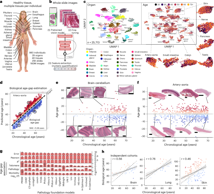 Histological aging signatures for monitoring tissue-specific aging and disease