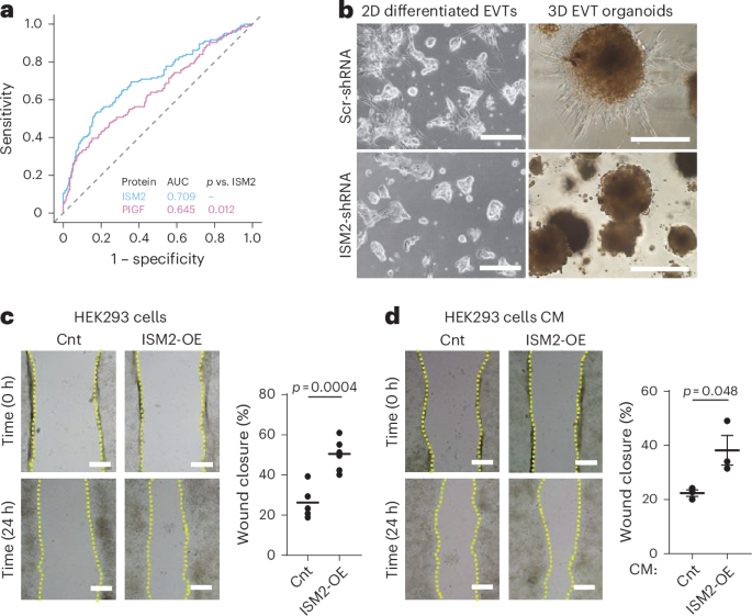 Isthmin 2 could determine the early origins of preeclampsia and fetal  growth restriction | Nature Medicine (via www.nature.com)