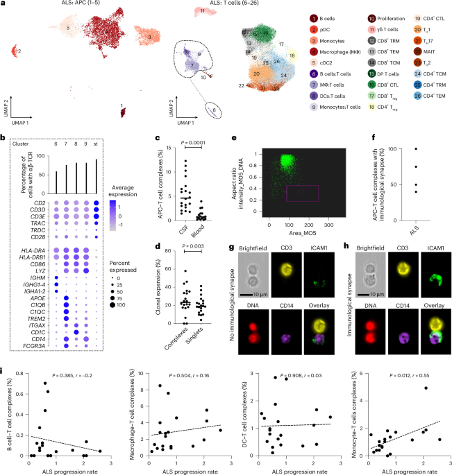 Single-Cell Immune Profiling and TCR Repertoire Analysis in Amyotrophic Lateral Sclerosis