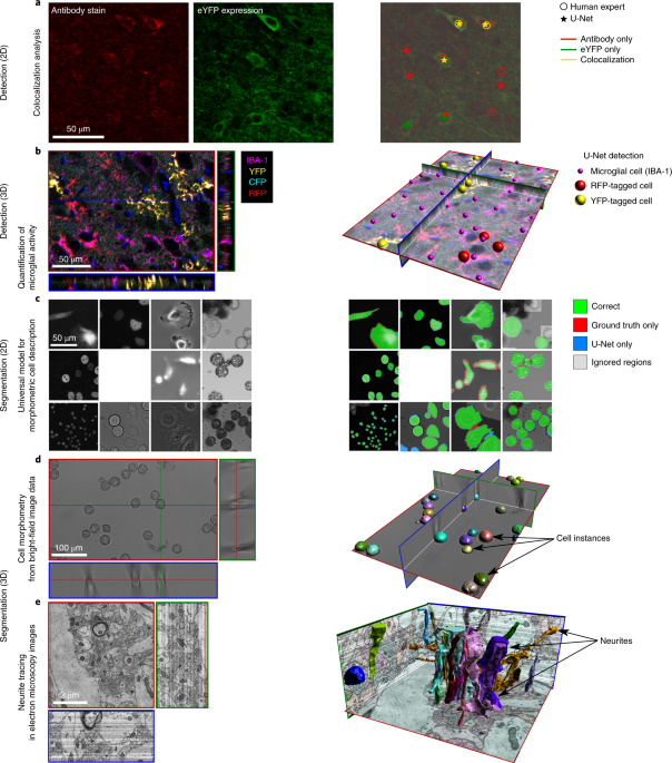 U-Net: deep learning for cell counting, detection, and morphometry