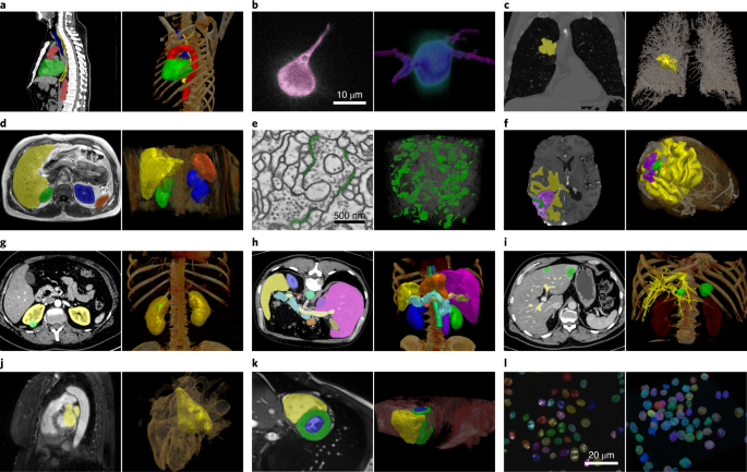 Nnu Net A Self Configuring Method For Deep Learning Based Biomedical Image Segmentation Nature Methods