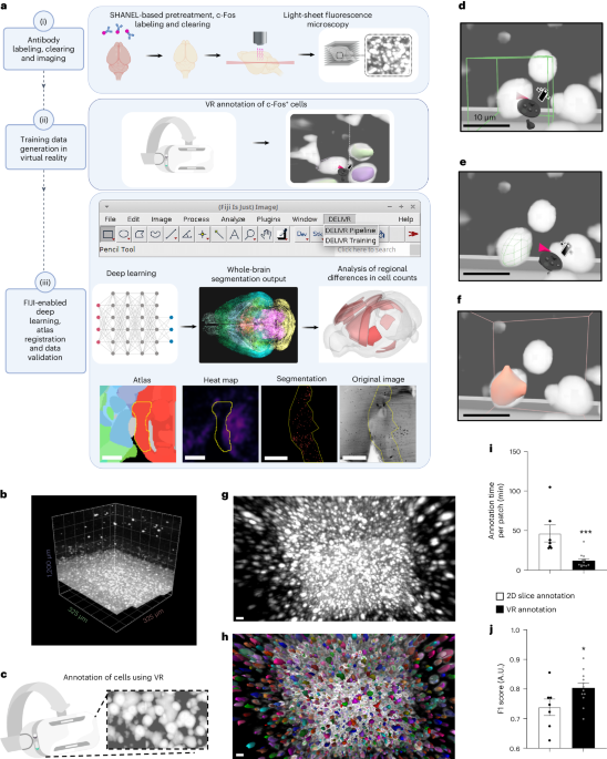 Automated detection of specific cells in three-dimensional datasets such as whole-brain light-sheet image stacks is challenging. Here, we present DELi