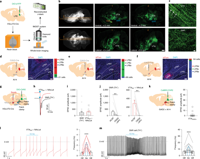 Pain Modulates Dopamine Neurons Via A Spinal Parabrachial Mesencephalic Circuit Nature Neuroscience