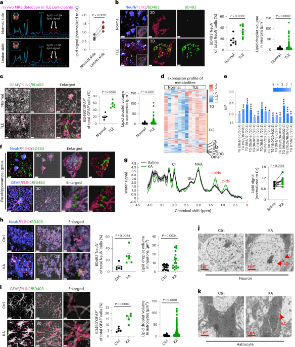 Lipid-accumulated reactive astrocytes promote disease progression in  epilepsy | Nature Neuroscience
