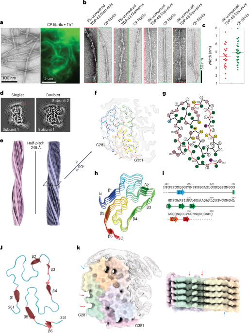 https://media.springernature.com/m685/springer-static/image/art%3A10.1038%2Fs41593-023-01341-4/MediaObjects/41593_2023_1341_Fig5_HTML.png