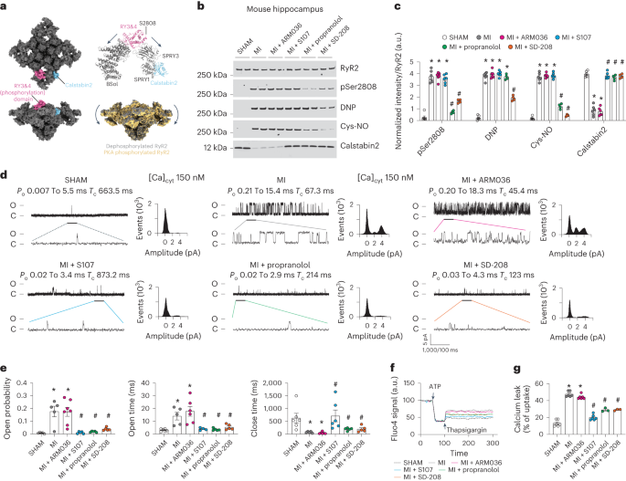 Heart failure-induced cognitive dysfunction is mediated by intracellular  Ca2+ leak through ryanodine receptor type 2