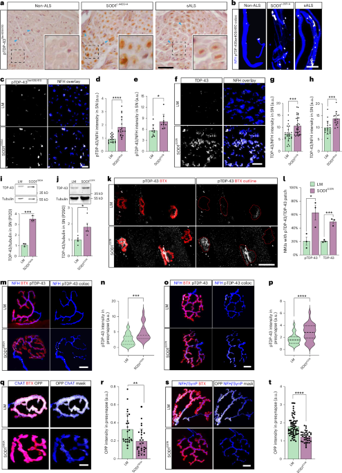 Muscle-derived miR-126 regulates TDP-43 axonal local synthesis and NMJ integrity