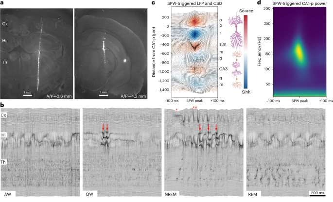 cjc-1295 ipamorelin effects on sleep slow-wave sleep A hippocampal 'sharp-wave sleep' state that is dissociable from cortical sleep