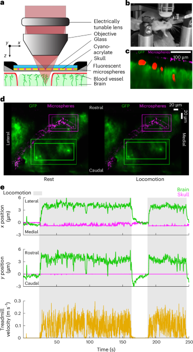Brain motion is driven by mechanical coupling with the abdomen