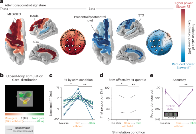Imagen ilustrativa: Nueva firma neuronal para predecir retrasos de atención — Investigación