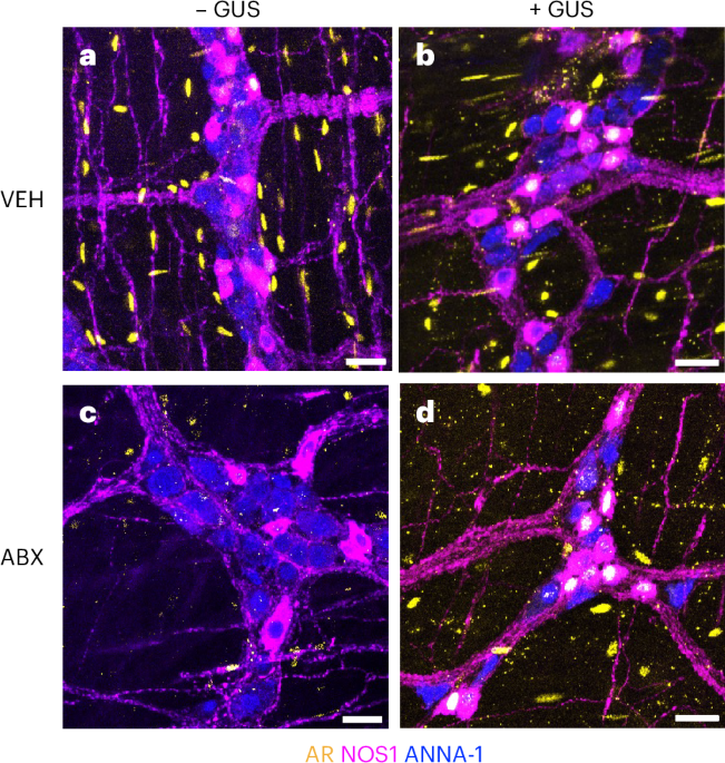Gut bacteria regulate intestinal motor circuits by metabolizing sex hormones - Nature Neuroscience
