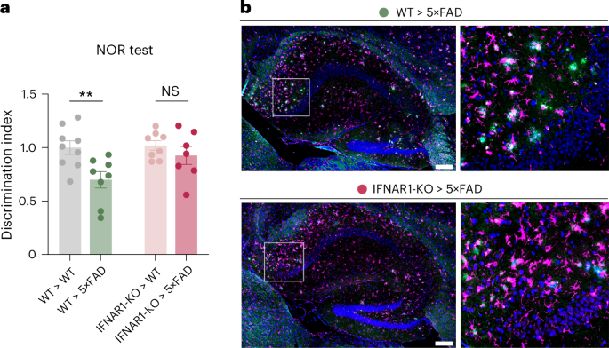 How Bone Marrow and Immune Cells Drive Alzheimer’s Disease