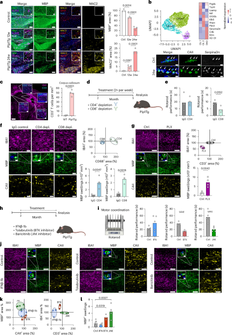 Chronic progressive demyelination induces a microglial state with lysosomal dysfunction
