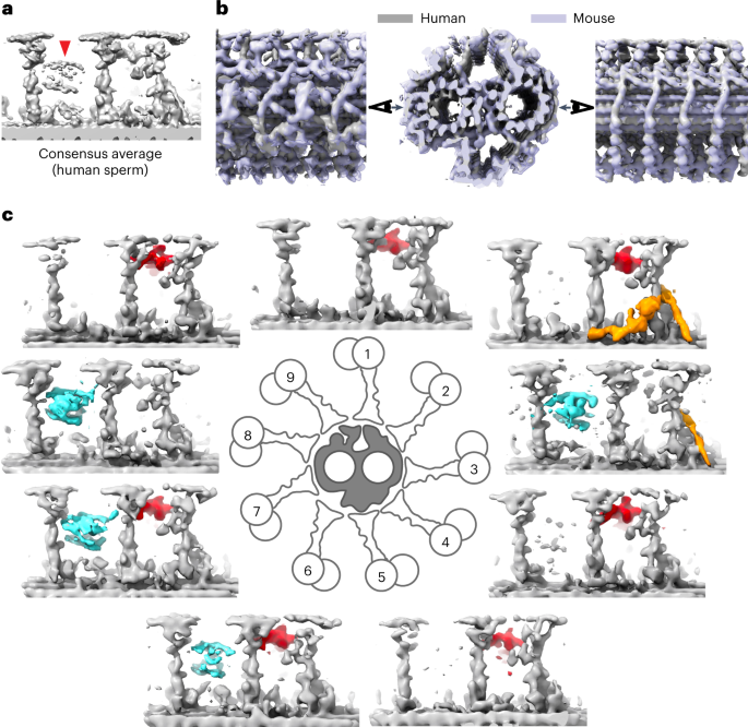 In situ cryo-electron tomography reveals the asymmetric