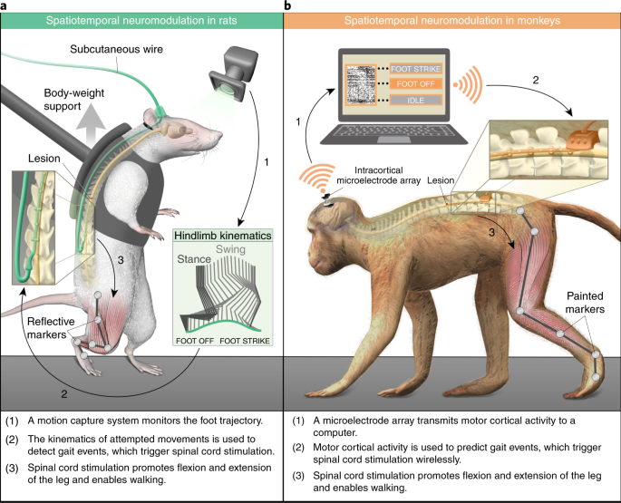 Configuration of electrical spinal cord stimulation through real-time processing of gait kinematics | Nature Protocols Configuration of electrical spinal cord stimulation through real-time processing of gait kinematics | Nature Protocols