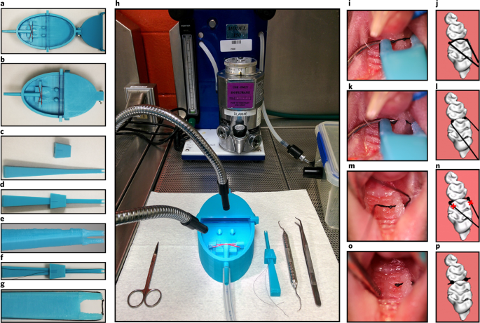 An experimental murine model to study periodontitis