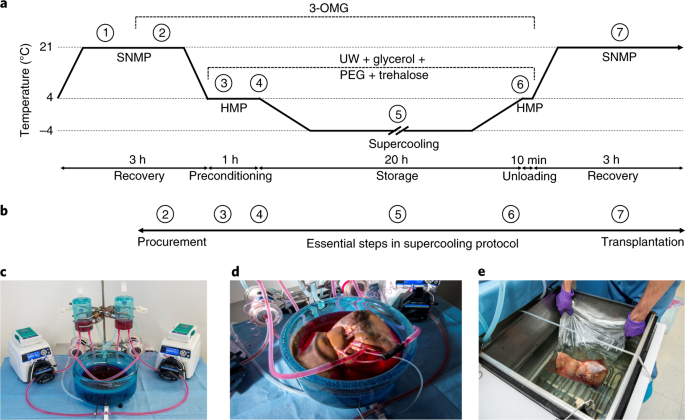 Subzero non-frozen preservation of human livers in the supercooled state