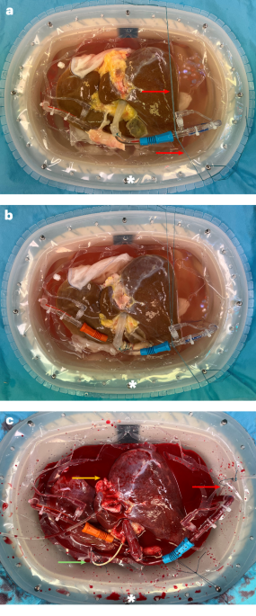 Back-to-base' combined hypothermic and normothermic machine perfusion of human donor livers | Nature Protocols Back-to-base' combined hypothermic and normothermic machine perfusion of human donor livers | Nature Protocols