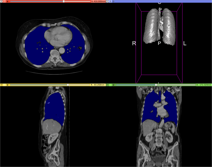 Ct Org A New Dataset For Multiple Organ Segmentation In Computed Tomography Scientific Data