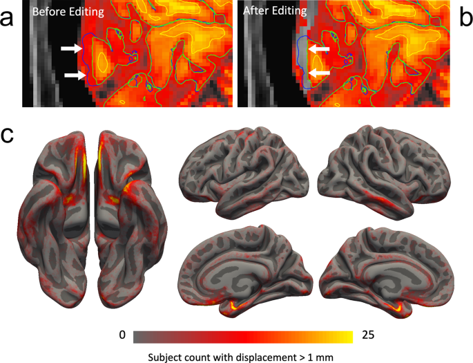 Caltech Scientists Can Predict Intelligence from Brain Scans