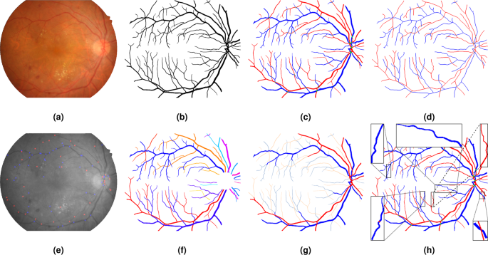 The RETA Benchmark for Retinal Vascular Tree Analysis