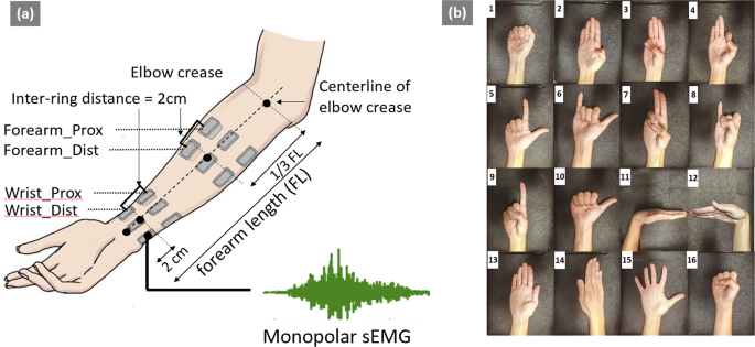 Multi-day dataset of forearm and wrist electromyogram for hand ... - Nature.com