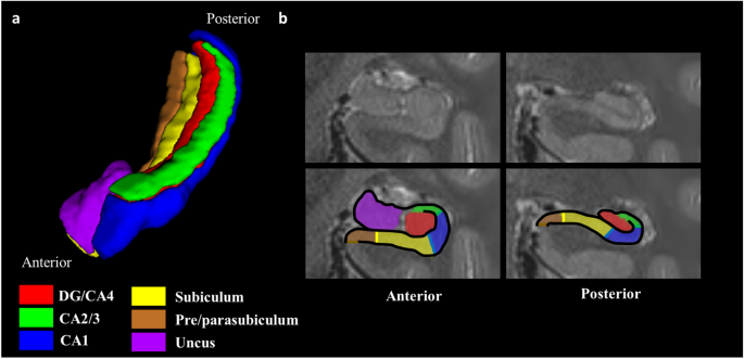 Release of cognitive and multimodal MRI data including real-world 