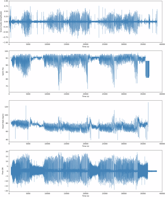 Comprehensive Multimodal Dataset for Training Deep Learning Models in Sleep Apnea Detection and Analysis